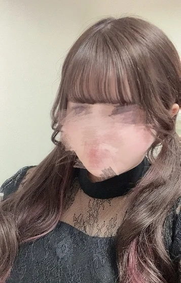 るい(26)