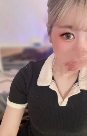 ルナ(22)